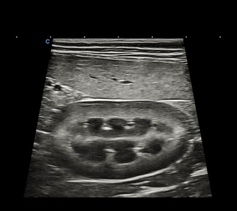 УЗИ почки линейным датчиком на CHISON SonoPort Ultramatrix VET