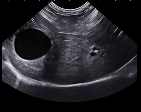 УЗИ печени на CHISON SonoPort Ultramatrix VET