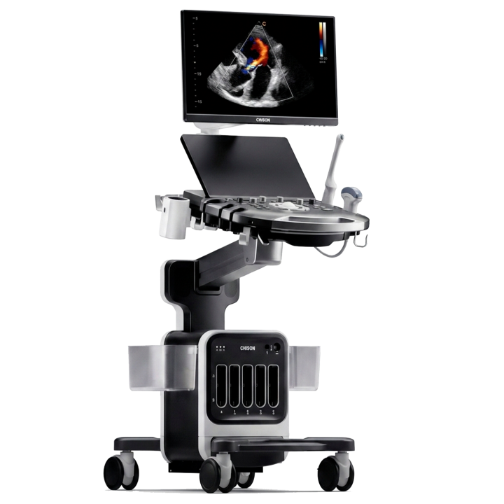 CHISON SonoPort Ultramatrix VET — вид спереди с монитором